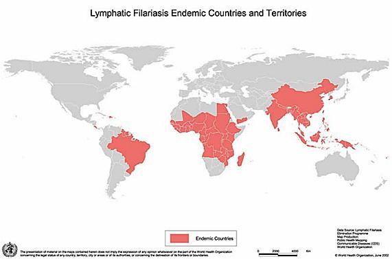 1.4 Epidemiology 1.4.1 Global Distribution Lymphatic filariasis is endemic in 73 countries (WHO, 2012), http://www.who.int/wer mainly in the tropics; both north and south (Fig. 2.2). India, Indonesia, Nigeria and Bangladesh account for nearly 70% of lymphatic filariasis cases.