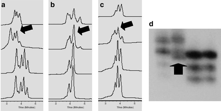 529 Fig. 3a d Microsatellite instability (MSI) analysis of the dinucleotide markers D2S123, D5S346, and D17S250.