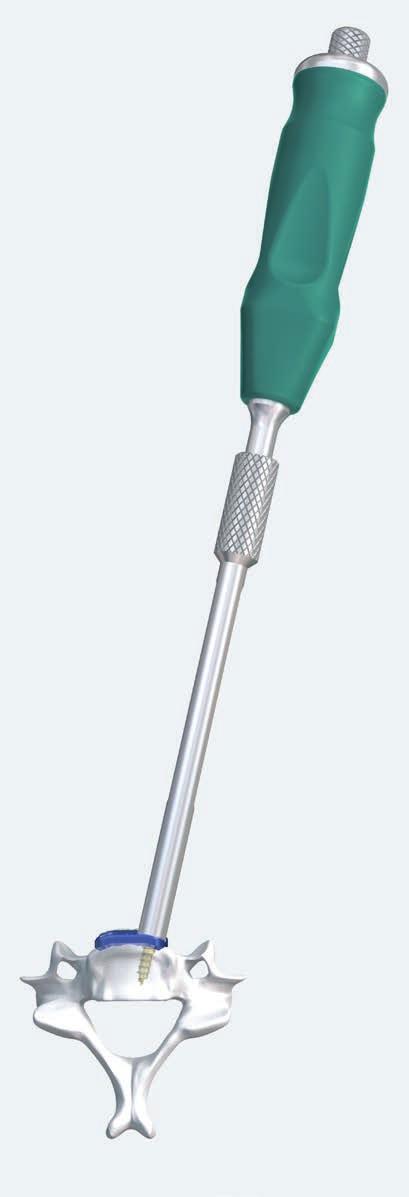 Implant Removal 1 Clean screw head Required Instrument 324.