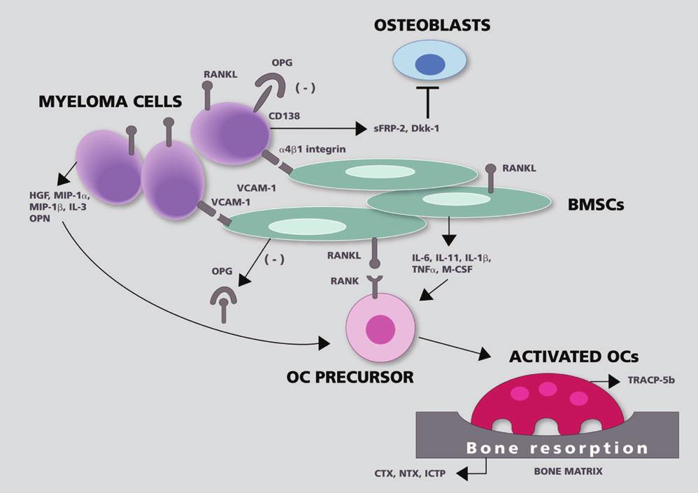 Figure 1. Overproduction of cytokines with osteoclast activation function results from interaction between myeloma cells and bone marrow stromal cells (BMSCs).