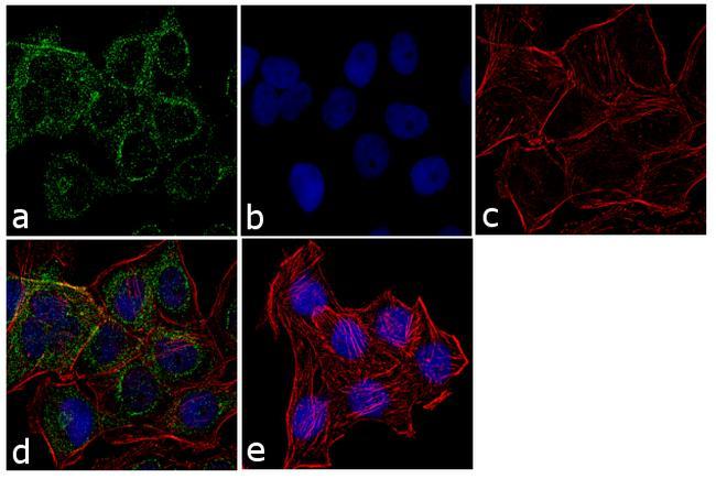 Product Images For TSH Receptor Monoclonal Antibody (49) TSH Receptor Antibody (MA3-218) in IF Immunofluorescence analysis of Thyrotropin Receptor was performed using 70% confluent log phase A431