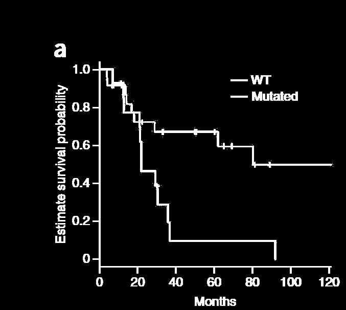 SETBP1 Muta>on in 30% of Atypical CML