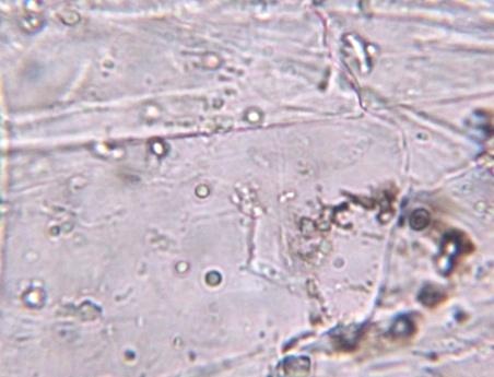 cells Fig 4: Parenchyma