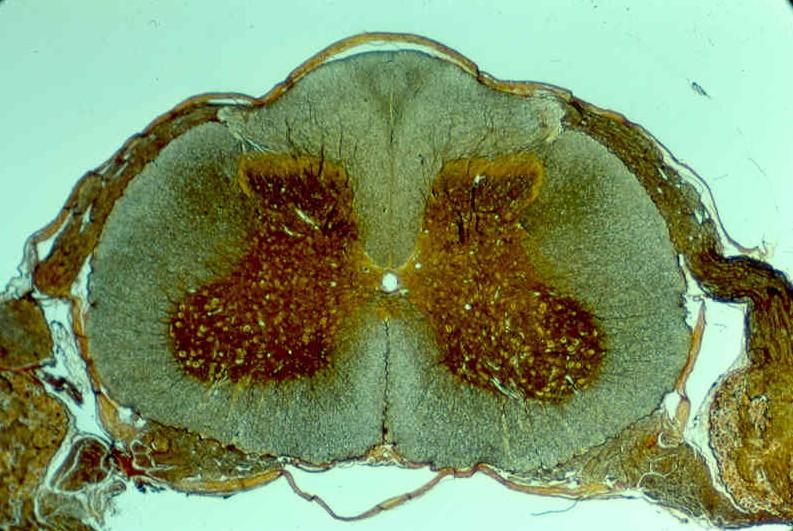 Spinal Cord Cross Section Dorsal root