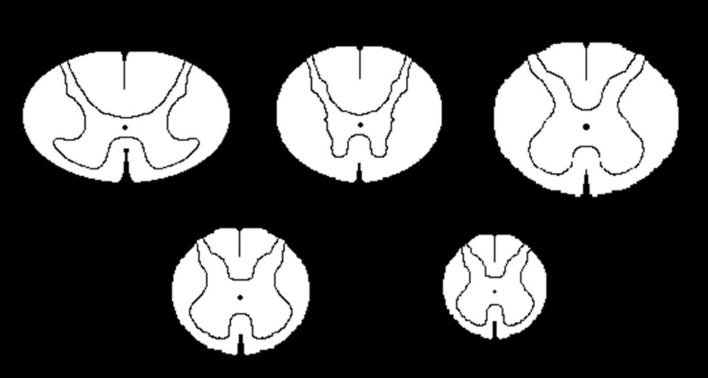 Volume of Gray & White Matter Cervical 5 Thoracic 7 Lumbar 4 Sacral 3 Coccygeal 1 Gray matter