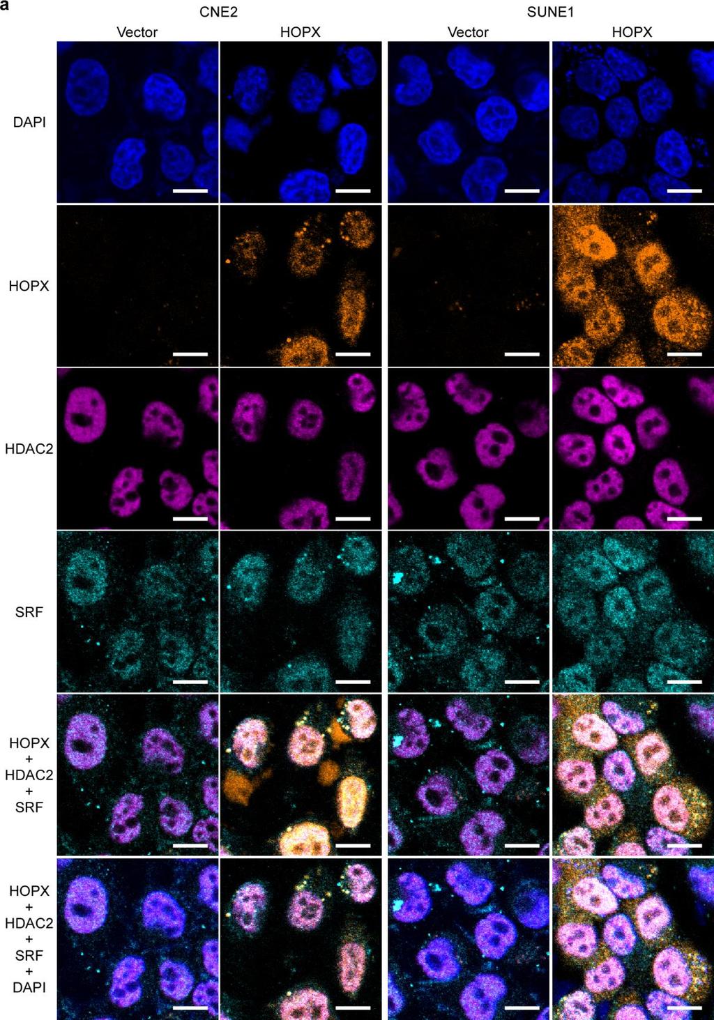 Supplementary Figure 10. HOPX is co-localized with HDAC2 and SRF in NPC cells.