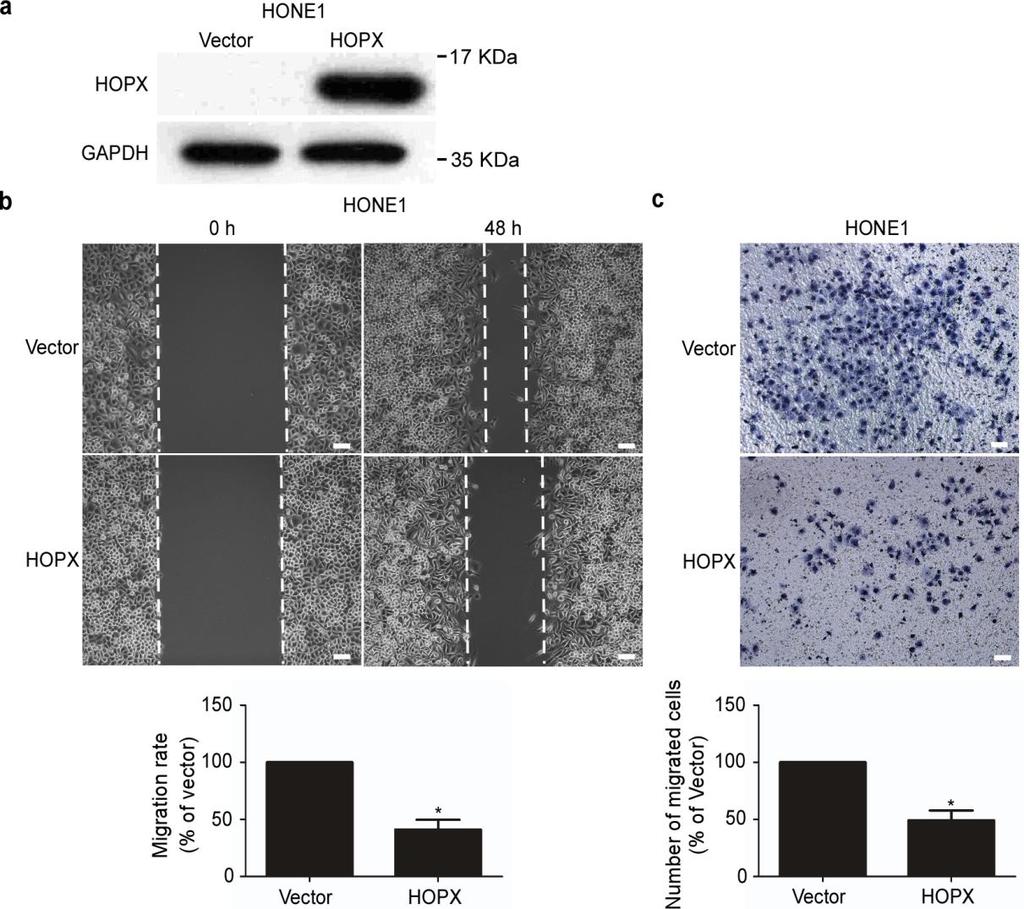 Supplementary Figure 3. HOPX suppresses HONE1 cell migration in vitro. (a) The ectopic expression of HOPX in HONE1 cells was confirmed by western blotting.