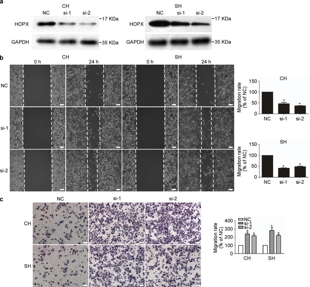 Supplementary Figure 4. Silencing HOPX promotes NPC cell migration in vitro.