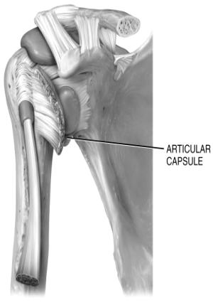 Joint capsules are composed of dense irregular C.T., lined by a synovial membrane They encompass the joint cavity and the synovial fluid within it Ligaments are bands of dense regular C.T. (like tendons) that join one bone to another bone Notice that ligaments can blend with other C.