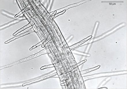 ROOT HAIR CELLS Extensions