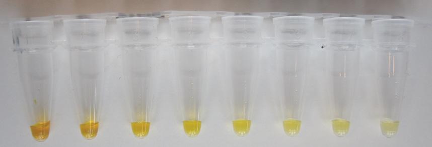 The potential impact of certain known interfering serum and plasma components was evaluated by using serial dilutions of bilirubin, hemolysate, and lipids, respectively in EDTA plasma, as shown in