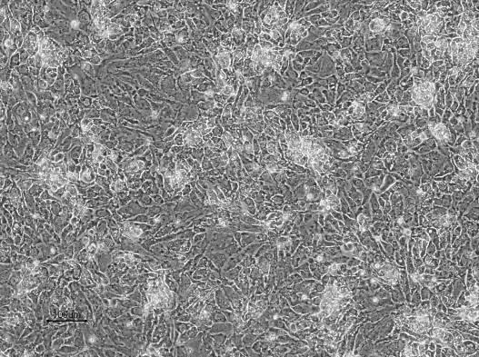 The differentiated hepatocyte cells are ready to be used in your preferred application beginning on day 14 after the start of DE differentiation.