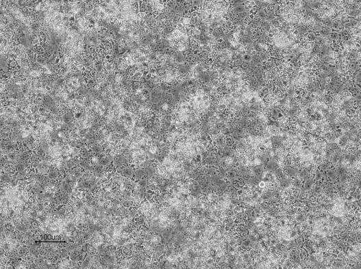 Day 2 after start of hepatocyte differentiation 10X (Scale