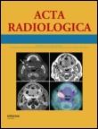 Acta Radiologica ISSN: 0284-1851 (Print) 1600-0455 (Online) Journal homepage: