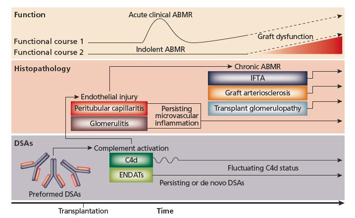 Natural History of Antibody-Mediated Allograft Deterioration 1 ENDAT: endothelial activation and injury