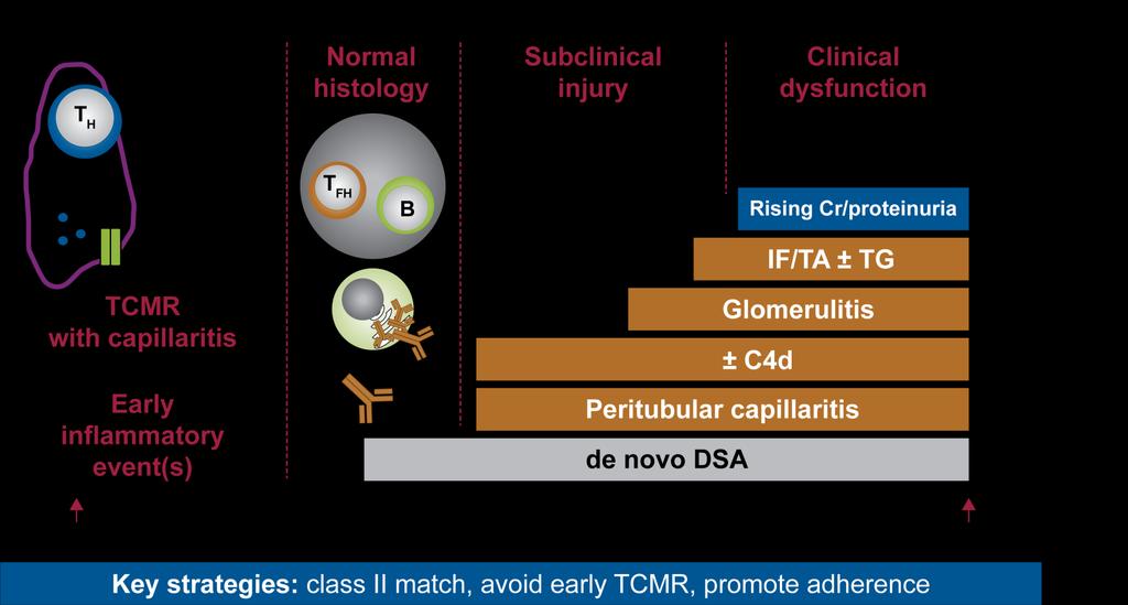 Model Linking TCMR, dndsa, and AMR With Graft Loss 1 Source: