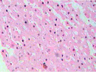 diabetic control Figure 1: Rat liver treated with gum acacia with normal hepatic architecture (45X) levels in diabetic rats treated with either ethanolic extract of Tamarindus indica or metformin