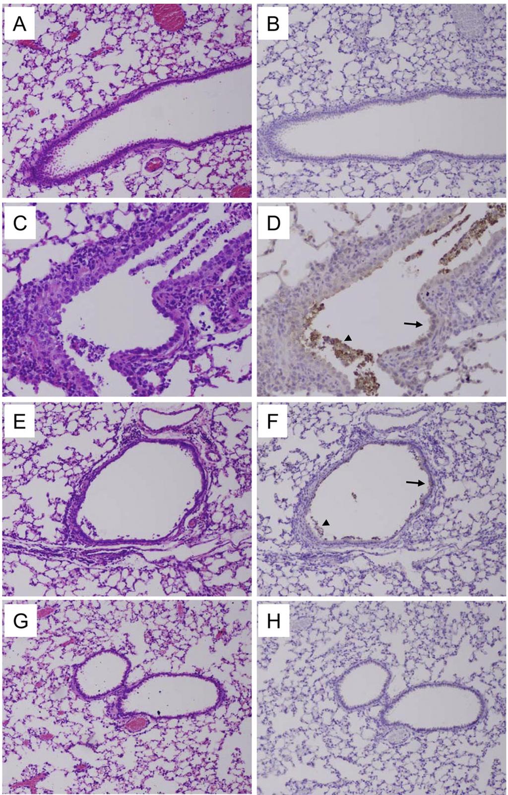 PB2-E627K and the 2009 H1N1 Pandemic Virus Polymerase FIG 4 Pathology and immunohistochemistry of influenza virus-infected mouse lung tissue.