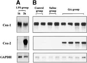 Oguma, Asano, Shiomi, et al.: COX-2 in Allergic Inflammation 383 MI) were subjected to sodium dodecyl sulfate polyacrylamide gel electrophoresis (7.5% Tris-HCl gel) and Western blot analysis (10).