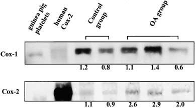 384 AMERICAN JOURNAL OF RESPIRATORY AND CRITICAL CARE MEDICINE VOL 165 2002 Figure 3. Western blot analysis of COX-1 and COX-2 proteins in guineapig lungs.