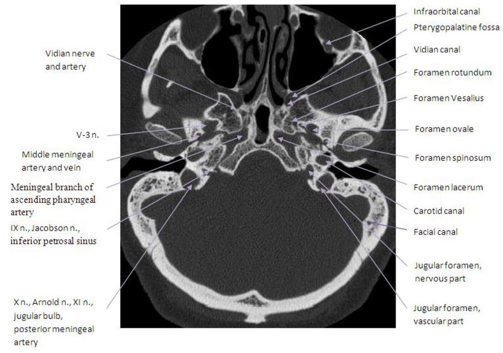 Fig. 1: Axials contrast-enhanced CT.