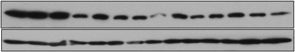 LnCap Du PC3 JHH- HpG U87 TIMP3 protein TUSC, normal TIMP, normal TIMP3, normal TUSC, tumour TIMP, tumour TIMP3, tumour Figure Expression of TUSC and TIMP/3
