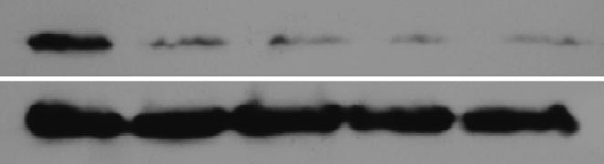 b-actin on the same membranes served as a loading control. (b) The cells transfected with different mirnas were subject to western blot analysis for expression of TIMP and TIMP3.