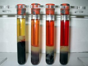 Hemolysis Hemolysis is the destruction (breakage) of the red blood cell s (RBC s) membrane, causing the release of the hemoglobin and other
