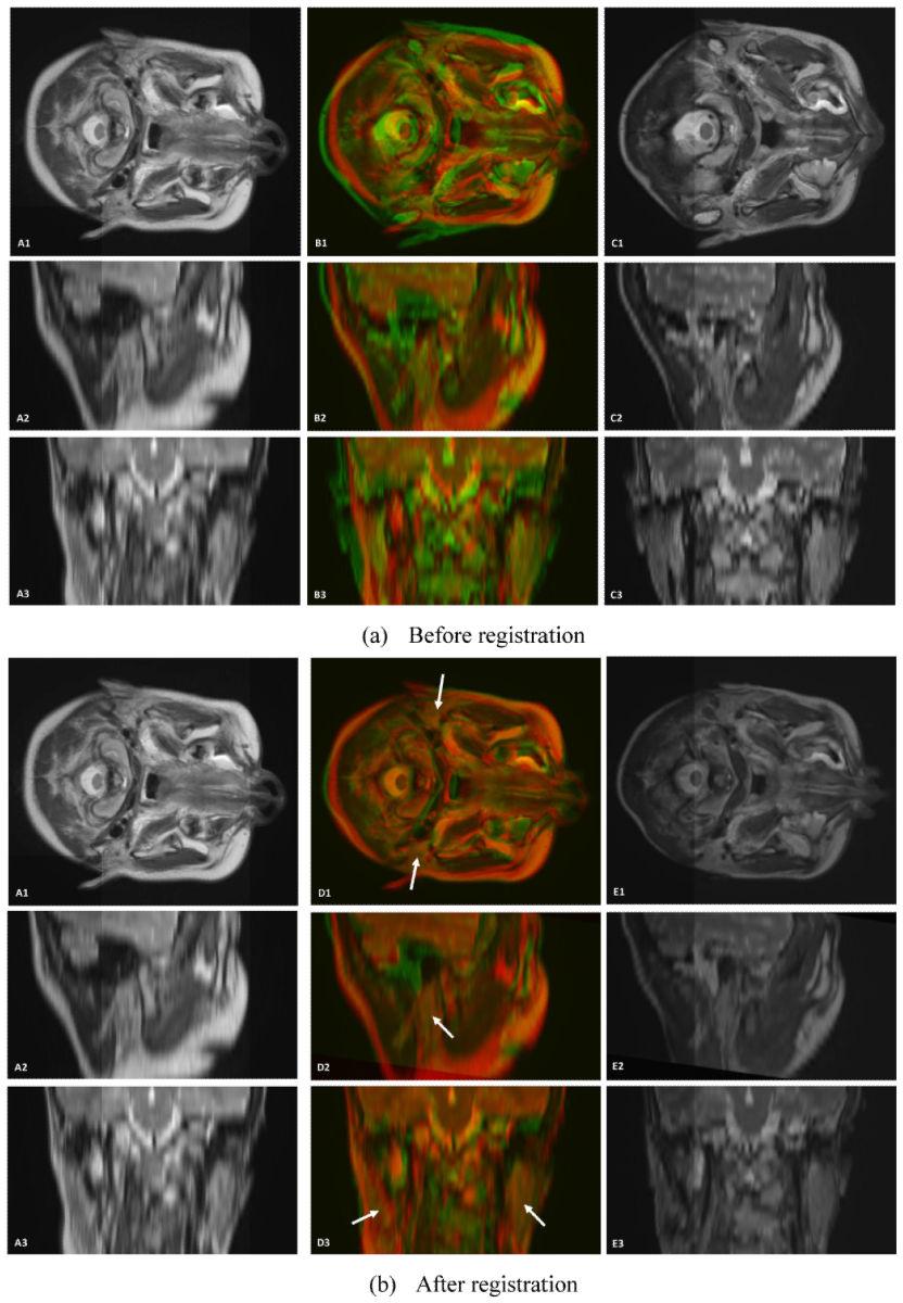 Cheng et al. Page 8 Figure 2. Visual assessment of the registration of 3D head-and-neck MR images.