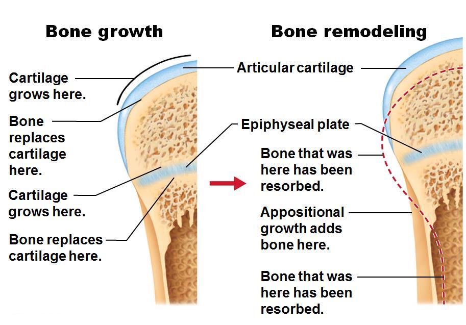 Appositional Growth increase thickness; occurs throughout life 1. Osteoblast beneath the periosteum secrete bone matrix on external bone and osteoclasts under the endosteum remove bone. 2.