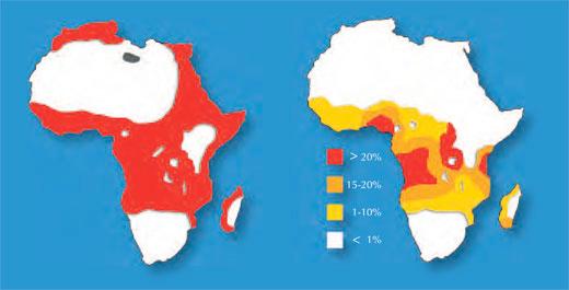 Sickle Cell Anemia Comparison of the distribution of
