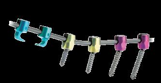 Minit The Minit Top-Loading System provides a simple and secure solution for providing rigid posterior fixation of the cervical and upper thoracic spine.