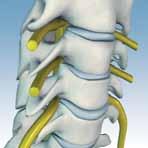 2 In a healthy spine, the vertebrae are separated by discs that act as cushions and allow the spine to move smoothly.