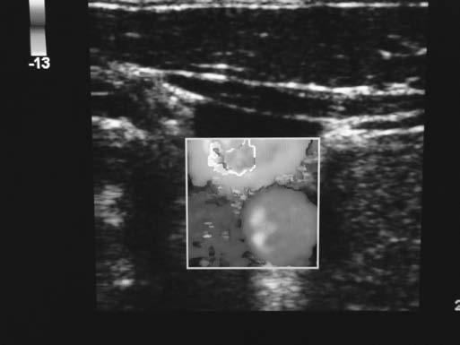 18-Levitov_CH18_p230-246.qxd 3/31/10 4:24 PM Page 232 232 Bedside Ultrasonography in Clinical Medicine (Fig. 18.1, bottom).