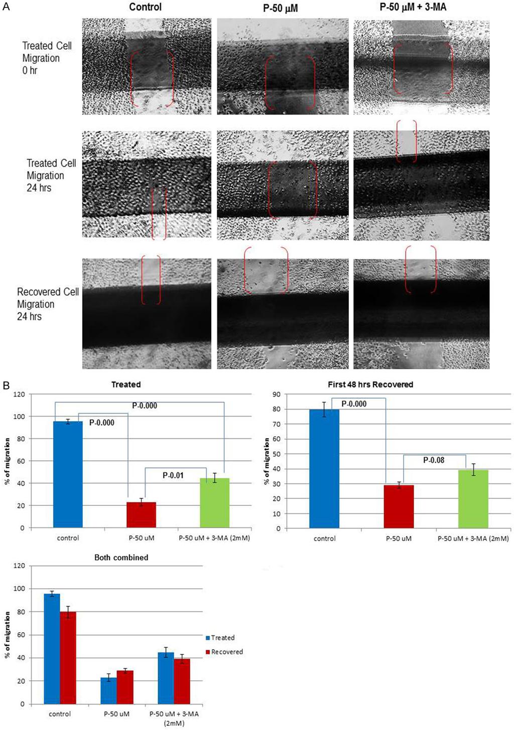 Figure 5. A. Treated, rescued and recovered cell migration function-cell pictures: Cell pictures clearly indicated the difference in migration between untreated control and P-50 um treated cells.