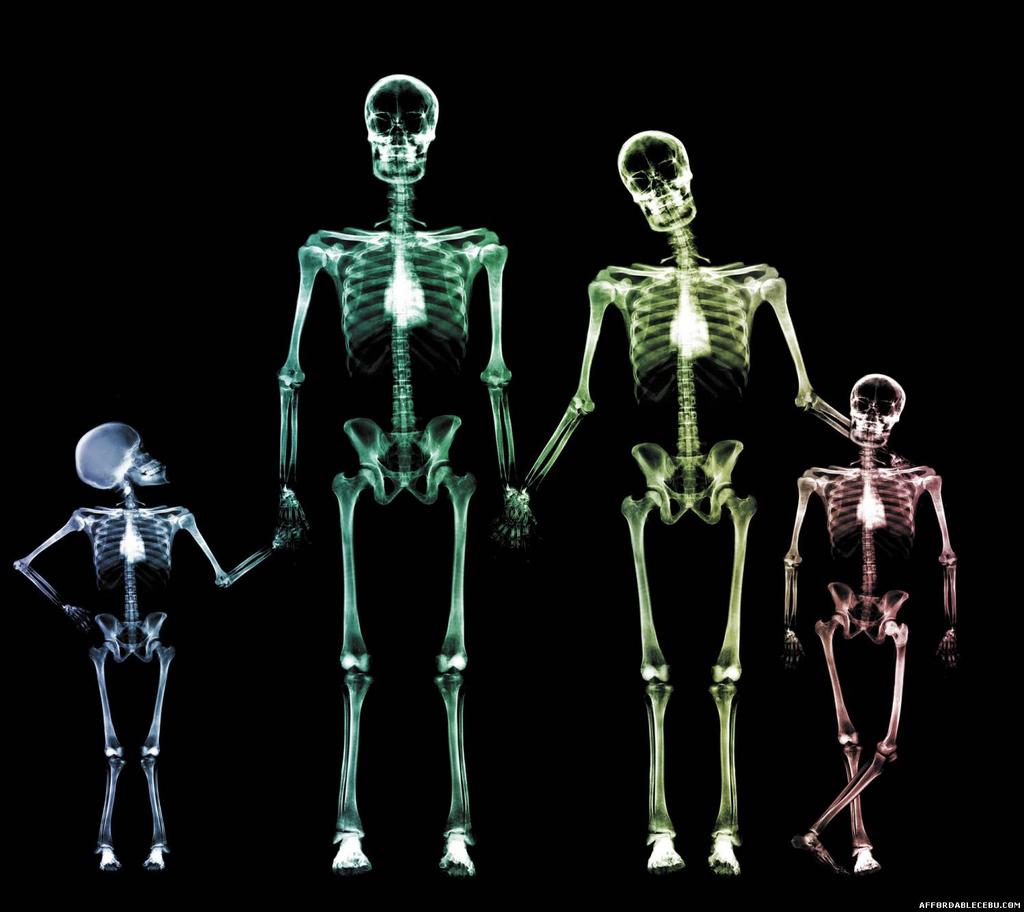 stores minerals, such as calcium, and it is constantly renewed, which is how our bones are able to heal. Bones are cleverly designed to allow movement at the joints and provide great stability.