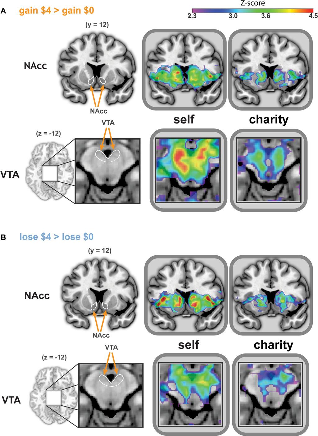 FIGURE 3 Whole-brain analysis reveals similar patterns of activation during anticipation of gains and losses, whether participants played for self or a charity.