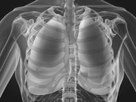 Learning Objectives Chronic Obstructive Pulmonary Disease Tracing the Diagnosis After learning from this CME session, you should be able to Outline clinical features that can be used to differentiate