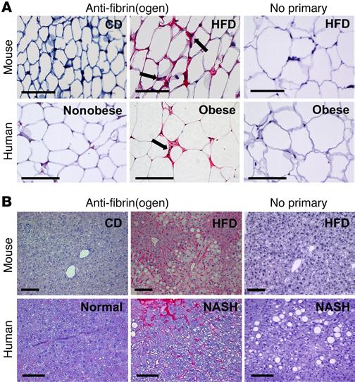 Figure 1. Fibrin(ogen) deposits accumulate in white adipose tissue of HFD-fed mice and obese human patients as well as in liver tissue of HFD-fed mice and patients with NASH.