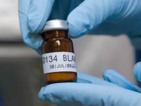 The Potential of New TB Vaccines A new, more effective TB vaccine could: Be safer and more effective