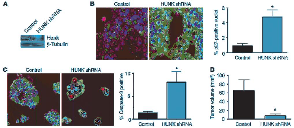 Figure 9 Hunk inhibits tumor formation of human breast cancer cells by modulating p27 localization and cell survival.