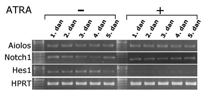4 Rezultati Slika 4.3 Ekspresija glasničke RNA za Aiolos, Notch1, Hes1 nakon pet dana izlaganja loze stanica NB4 s retinoičnom kiselinom (završna konc. 1µM).