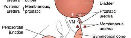 Urethral Injuries Posterior > anterior urethral injuries 2/3 posterior 1/3 anterior Ingram MD, et al.
