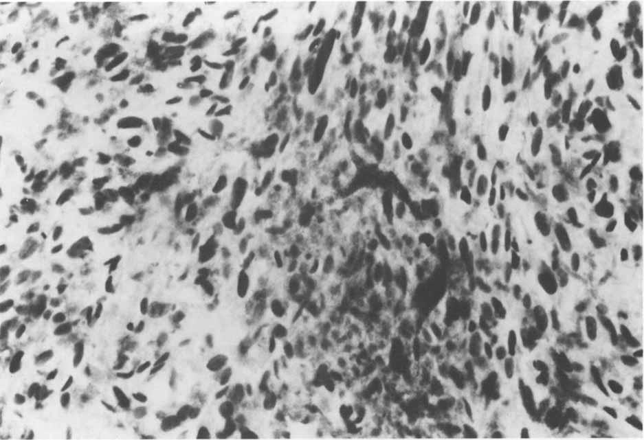 One or two positively stained cells are probably endothelial cells cut tangentially (alkaline phosphatase preparation, x