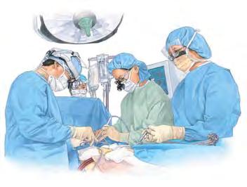 Preparing for Surgery With open surgery, a single large incision is made in the abdomen. A graft (a tube made of strong, flexible fabric) is then sewn into the artery above and below the aneurysm.