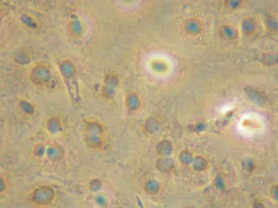 2A) to a combination of fibroblast-like and round, lipid-laden cells at day 5 (Fig. 2B), and then by day 10, nearly all cultured cells exhibited a round, unilocular lipid-laden-like shape (Fig. 2C).