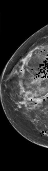 breast images in total and for these particular screening cases 90 of these images contained one to three key mammographic features.