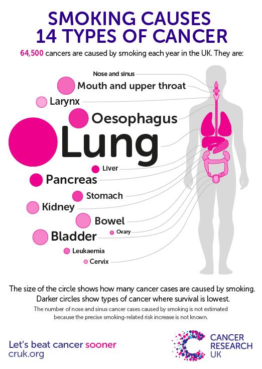 Cancer cases attributable to smoking as a proportion of all cancer cases, by cancer type, United Kingdom, 211 Lung 86% Laryngeal 79% Esophageal 65% Oral Cavity and Pharynx