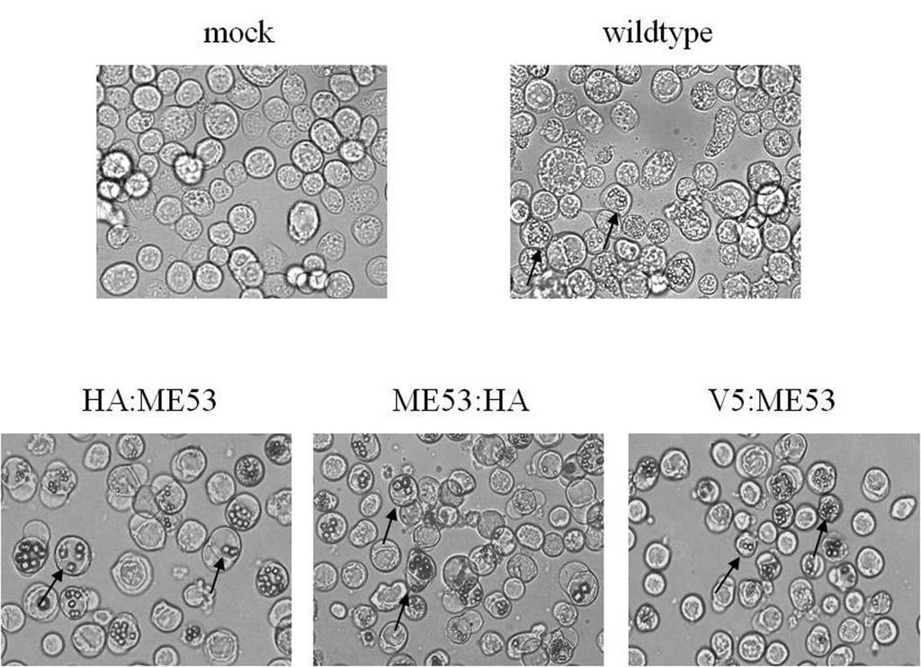Figure 4.2 OBs production in Sf21 cells infected with WT virus and recombinant viruses AcHA:ME53, AcME53:HA or AcV5:ME53. CPE was observed by 10X light microscopy.