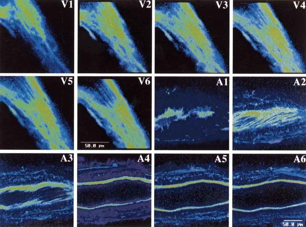 Fig. 1. Green fluorescent protein (GFP) transfection in coronary venules and arterioles.